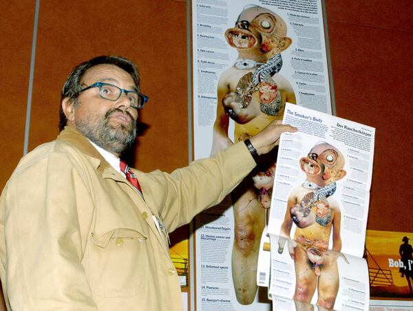 File - Italian photographer Oliviero Toscani holds a poster showing a "Smoker's Body" during a press conference on tobacco advertising, in Geneva, Switzerland, Thursday, March 21, 2002. (AP Photo/ Donald Stampfli, File)