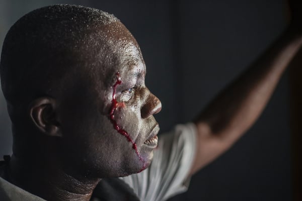 A wounded security officer looks on after being shot by armed gangs at the General Hospital in Port-au-Prince, Haiti, Tuesday, Dec. 24, 2024. (AP Photo/Jean Feguens Regala)