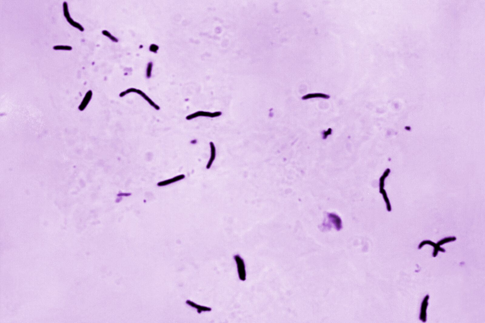 This 1966 microscope photo provided by the U.S. Centers for Disease Control and Prevention shows Mycobacterium tuberculosis bacilli, the organism responsible for causing the disease tuberculosis. (Elizabeth S. Mingioli/CDC via AP)